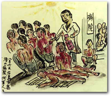 Badly burned survivors being treated